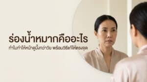 ร่องน้ำหมากคืออะไร ทำไมทำให้หน้าดูบึ้ง พร้อมวิธีแก้ให้ตรงจุด
